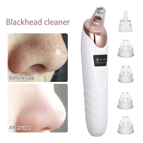 Blackhead Removal Machine Derma Suction 5 In 1 Black Head Remover Machine Acne Pimple Pore Cleaner Vacuum Tool Rechargeable Machine Oil Remover Multi-Functional Skin Care Tools Facial Beauty Device Whitehead Remover Deep face dust Cleaner